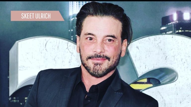 Skeet Ulrich